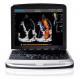 Easy To Carry 4D Chison SonoBook 9 Laptop Ultrasound Machine