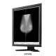 20.1 Inch Medical Grade Display Lcd Monitor 70w With Five Million Pixels