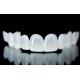 Removable Snap On Veneers Snow White Shade Good Fit Dental Design Service