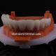 Good Fitting Precise  Esthetic Zirconia Crown zirconia porcelain crown pink porcelian with bleaching shade