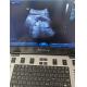 Mindray Laptop Original Ultrasound System M9 Curved array