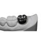 Natural Colour Stability FDA Dental Crown Bridge Corrosion Resistant