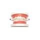 Tooth Model Dental Functional Appliance Teaching Denture Oral Model