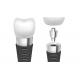 Titanium / Cobalt Chromium Dental Implant Rod Comfortable Highly Biocompatible Implant