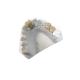 Yellow Gold Porcelain Dental Crown OEM High Strength New Condition