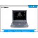 Automatic Identification Color Doppler Ultrasound Scanner With 15 Inch LED Medicinal Monitor Probe
