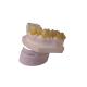 CAD CAM Design PFM Dental Crown Laboratory 3D Printer Dental Crowns