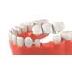 OEM Dental Crown Bridge Good Biocompatibility Smooth Surface Make Smile Sweeter