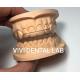 Night Dental Mouth Guard Occlusal Splint Ekodent Good Fit High esthetics