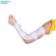 Low Temperature Thermoplastic Elbow Splint Elbow Joint Splint