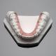 Hawley Wrap Around Orthodontic Retainer Dental Acrylic Palate