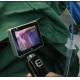 ICU EMS Single Use Intubation Video Laryngoscope With 1280 X 720 Camera Resolution