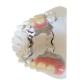 FDA PFM Dental Bridge Good Biocompatibility 3D Printing Dental Models