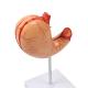 Anatomy Human Organs Gastric Diseased Dissection Stomach Teaching Model