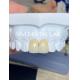 Accurate Dental Lab Crowns Ivoclar Esthetic Zirconia Crowns Natural Looking