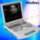 Medical Device Laptop Scanner Equipment Portable Color Doppler Ultrasound