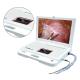 Hospital Machine Digital Video Portable Endoscope System