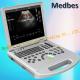 Ce Hospital Equipment Medical Diagnostic Ultrasounic Machine Digital Laptop