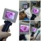 Operating Portable Video Laryngoscope Using In Routine Endotracheal Intubation