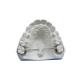Dental Functional Appliance, High Precision, Smooth Surface, Comfortable To Wear