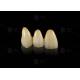 Durable Hypoallergenic EMAX Bridge Extreme Esthetics Emax Dental Bridge