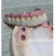 High Esthetics Dental Implant Crown / Screw Retained Crown ISO Approved