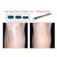 940nm At Home Spider Vein Removal Machine 15 Watt Pain Free Laser Therapy