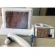 Digital Handheld Video Dermatoscope with 8 Inch Screen 1,4,9 Pictures Displaying