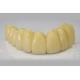Dental PMMA Provisional Crown Translucency Esthetic IPS E Max Crown