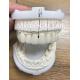 High Esthetics Zirconia Dental Lab Crowns Bridge With Layered Porcelain