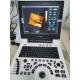 Xianfeng Pregnancy Color Doppler Ultrasound Machines Images 4B OEM