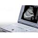 Portable Ultrasound Machine for Pregnancy Portable Ultrasound Scanner Only 2
