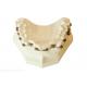 Dental Brackets Orthodontics Fixed Tooth Modeling Tools Dental Braces