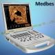 15-Inch Portable Ultrasound Scanner with Convex Probe (M-C60PLUS)