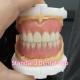 OEM Standard Dental Lab Full Removable Dentures Easy To Take In And Out