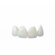 Easy Cleaning All Ceramic Crowns Transparent Natural Shade Customizable