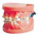 Dislocation Fixed Orthodontic Model For Medical College And Dental Hospital Training