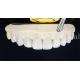 0.3-0.5mm Ceramic Laminate Teeth False Teeth Veneers With Adhesive Bonding