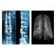 Sharp Radiographic Medical X Ray Films , Mri Dr Ct Digital Dry Imaging Film