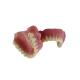 Porcelain Dental Crown Realistic Appearance Confident And Beautiful Color Stable
