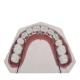 Straight Wire Fixed Orthodontic Appliances For Teeth Straightening