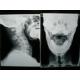 High Density Medical Imaging Film X Ray Dry For Fuji 3000 / 2000 / 1000