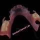Esthetic Flexible Valplast Dental Partials Acrylic Partial Denture