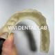 Empty PMMA Temporary Bridge Dental Professional For Implant Cases