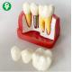 Anatomical Patient Education Models Dental / Teeth Demonstration Model