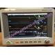 Portable Multi Parameter Used Patient Monitor IM60 Vital Sign Machine