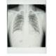 Konida Laser Printer Medical X-Ray Film 11in x 14in KND-K CE Approved