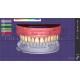 Dental Teeth Design Service With Prosthesis Planning And Oral Implant Designs