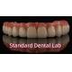 Professional High Esthetics Porcelain All On 4 Zirconia Bridge Dental Implants