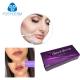 Ultra3 Ultra4 Voluma Hyaluronic Acid Dermal Filler Gel Juvederm Lip Filler 24mg/Ml